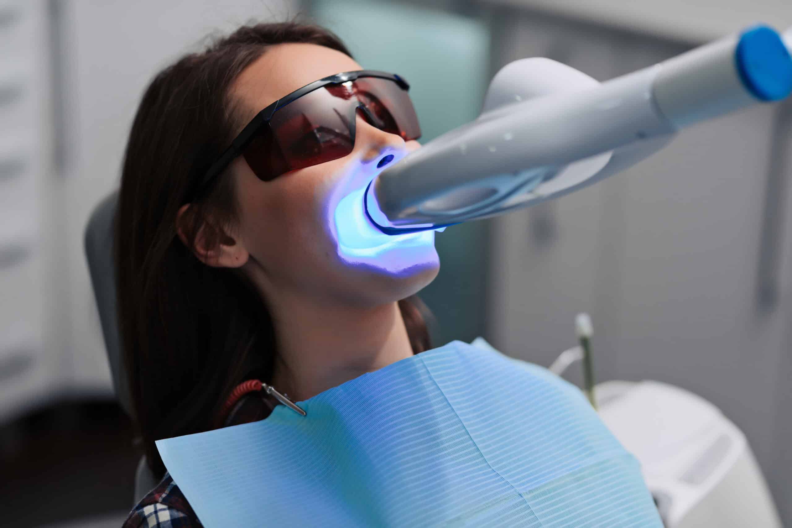Laser Teeth Whitening